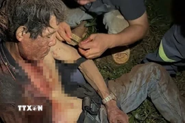 Lực lượng cứu nạn cứu hộ kịp thời cứu sống anh Viện từ giếng sâu 20 mét. (Ảnh: TTXVN phát)