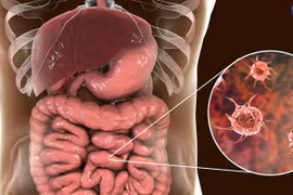 Trực khuẩn Shigella là nguyên nhân gây ra bệnh lỵ trực trùng. (Ảnh: Trung tâm tiêm chủng VNVC)