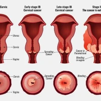 (Ảnh minh họa. Nguồn: singingriverhealthsystem)