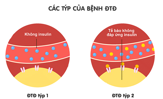 Những lưu ý trong chế độ ăn uống của người bị đái tháo đường ảnh 2