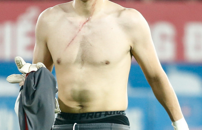 Cầu thủ Thanh Hóa cào rách ngực thủ môn Việt kiều Hải Phòng ảnh 3