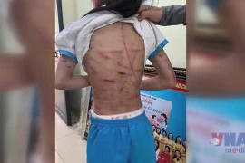 Bắt khẩn cấp cha dượng dùng búa đinh đánh đập bé gái 9 tuổi ở Hà Tĩnh