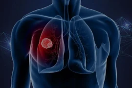 Ảnh minh họa. (Nguồn: WCRF)