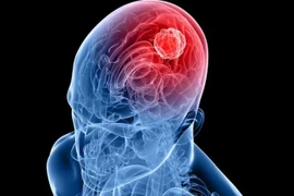 Ảnh minh họa. (Nguồn: Aaroncohen-gadol)