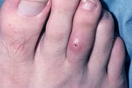 (Nguồn: Medscape)