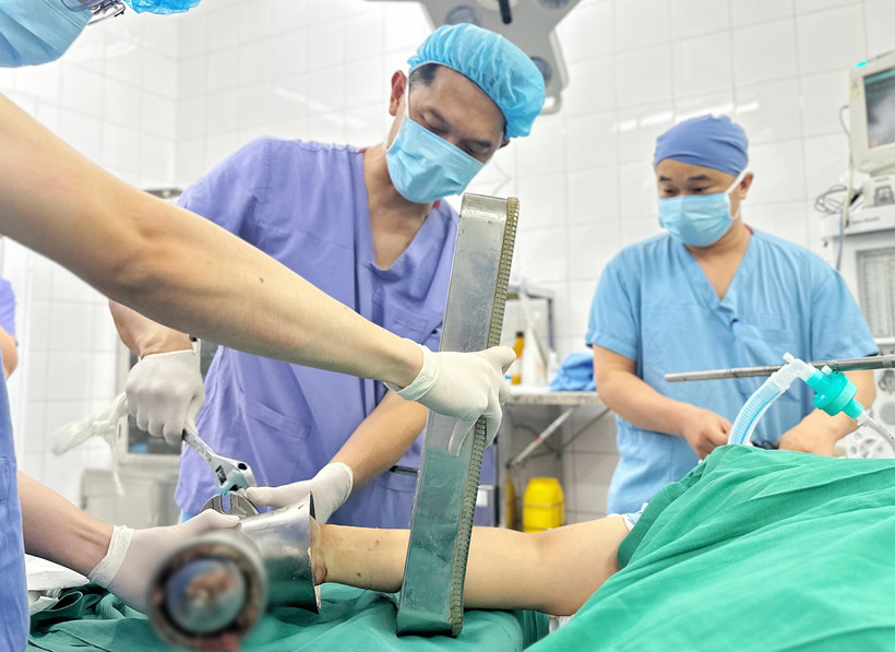 Bệnh nhân nhập viện trong tình trạng bàn tay vẫn còn kẹt nguyên trong máy xay thịt. (Ảnh: PV/Vietnam+)