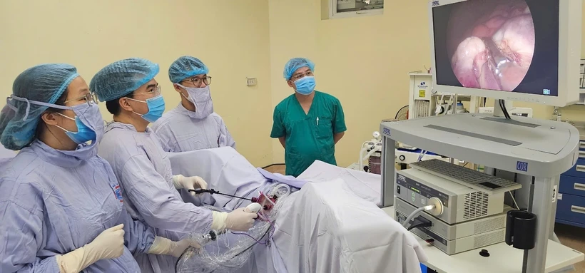 Các bác sỹ thực hiện ca phẫu thuật nội soi cho bệnh nhân. (Ảnh: PV/Vietnam+) Các bác sỹ thực hiện ca phẫu thuật nội soi cho bệnh nhân. (Ảnh: PV/Vietnam+)