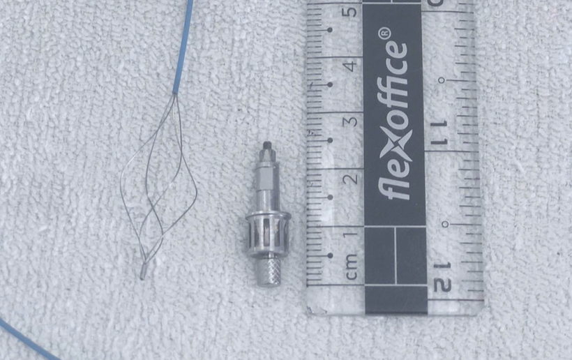 Dị vật là dụng cụ nha khoa bằng kim loại dài 2,5 cm được các bác sỹ lấy ra khỏi phế quản của bệnh nhân. (Ảnh: PV/Vietnam+)