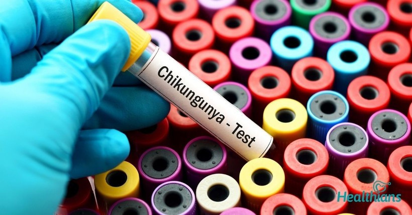 Hiện nay, dịch bệnh Chikungunya đang có xu hướng gia tăng. (Ảnh: PV/Vietnam+)