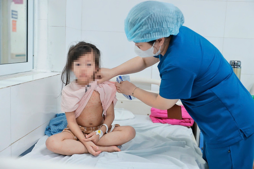 Điều trị cho bệnh nhân mắc sởi tại Bệnh viện Thanh Nhàn. (Ảnh: Minh Quyết/TTXVN) 