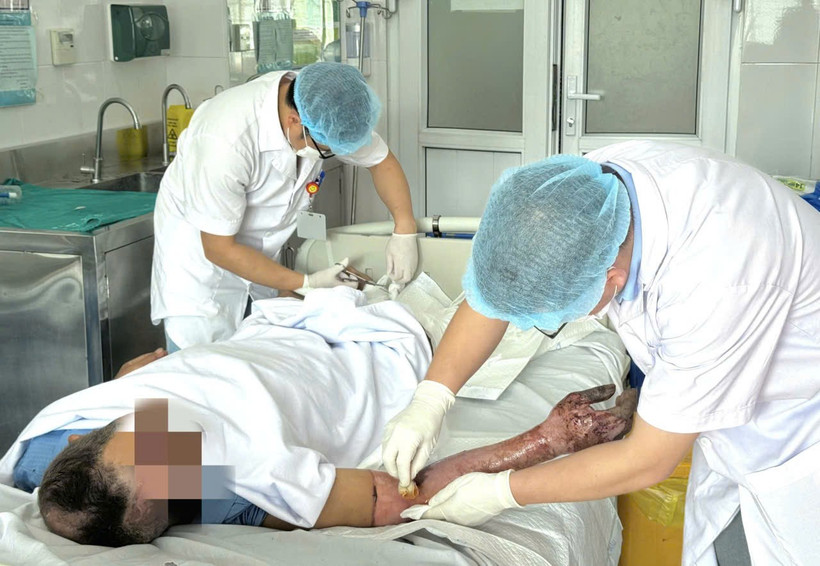 Các bác sỹ theo dõi và xử lý vết thương cho bệnh nhân. (Ảnh: PV/Vietnam+)