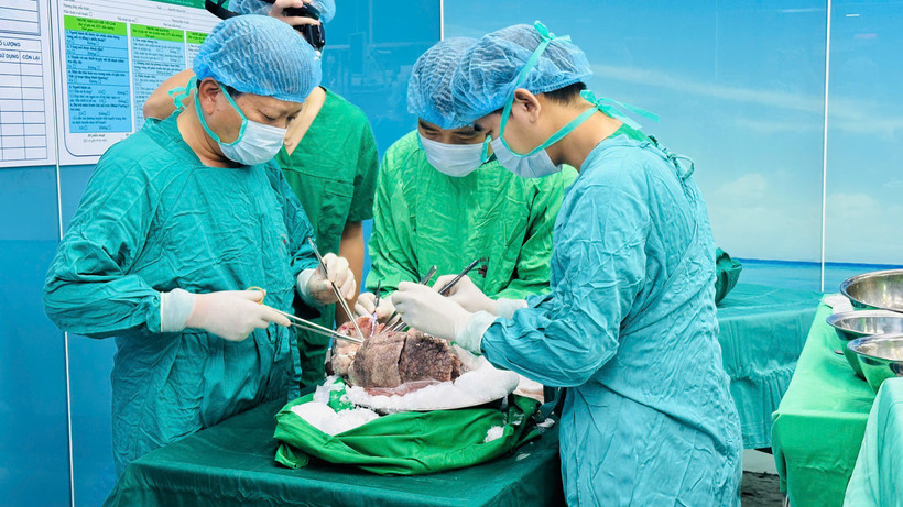 Các bác sỹ Bệnh viện Phổi Trung ương chuẩn bị thực hiện một ca ghép phổi. (Ảnh: PV/Vietnam+)