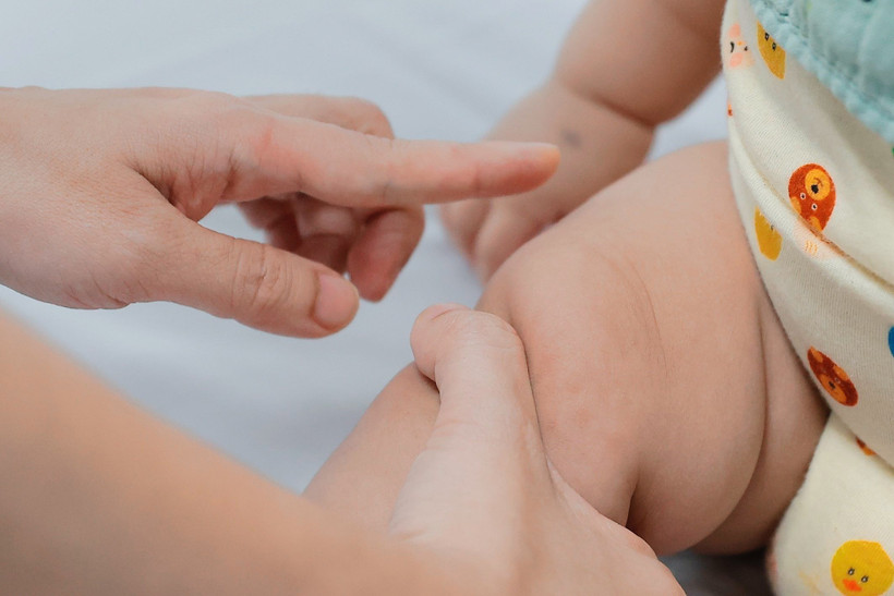 Biểu hiện lâm sàng bệnh tay chân miệng thường có nốt đỏ ở chân, tay và miệng. (Ảnh: Minh Quyết/TTXVN)