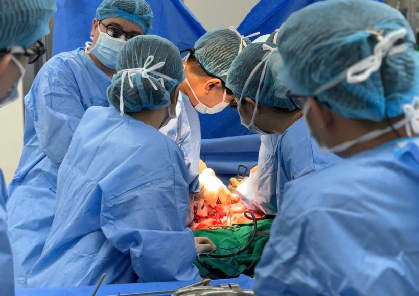 Các bác sỹ thực hiện ca ghép gan cho bệnh nhân. (Ảnh: PV/Vietnam+)