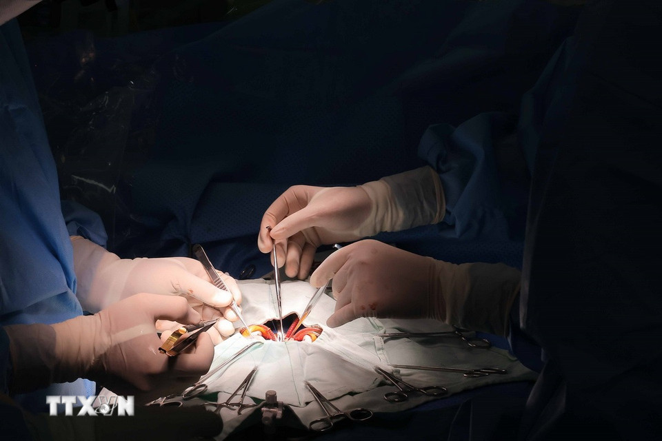 "Trẻ em không phải người lớn thu nhỏ", đặc biệt mạch máu của tim rất bé, nên các bác sỹ phẫu thuật phải tìm mọi cách bảo tồn mạch máu bị hỏng, phải có kỹ năng cao về vi phẫu. (Ảnh: Hoàng Hiếu/TTXVN)