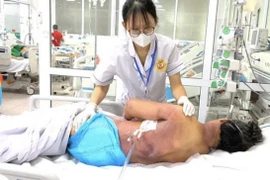 Bệnh nhân được chẩn đoán nhiễm khuẩn huyết, viêm mô mềm, sốc độc tố do tụ cầu vàng. (Ảnh: Bệnh viện cung cấp)