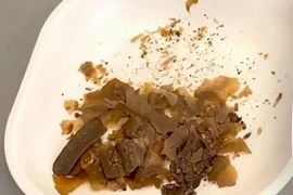 Các nhà nghiên cứu cho biết cặn bã được tìm thấy trong một chiếc bình cổ thời La Mã cung cấp bằng chứng hóa học đầu tiên về việc sử dụng phân làm thuốc. (Ảnh: Getty Images)