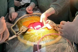 Các bác sỹ thực hiện ca phẫu thuật. (Ảnh: Beicheng Sun)