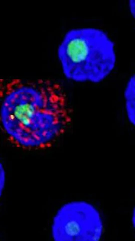Nghiên cứu mới cho thấy thuốc lenacapavir có thể ức chế virus HIV trong cả năm. (Nguồn: Science.org)