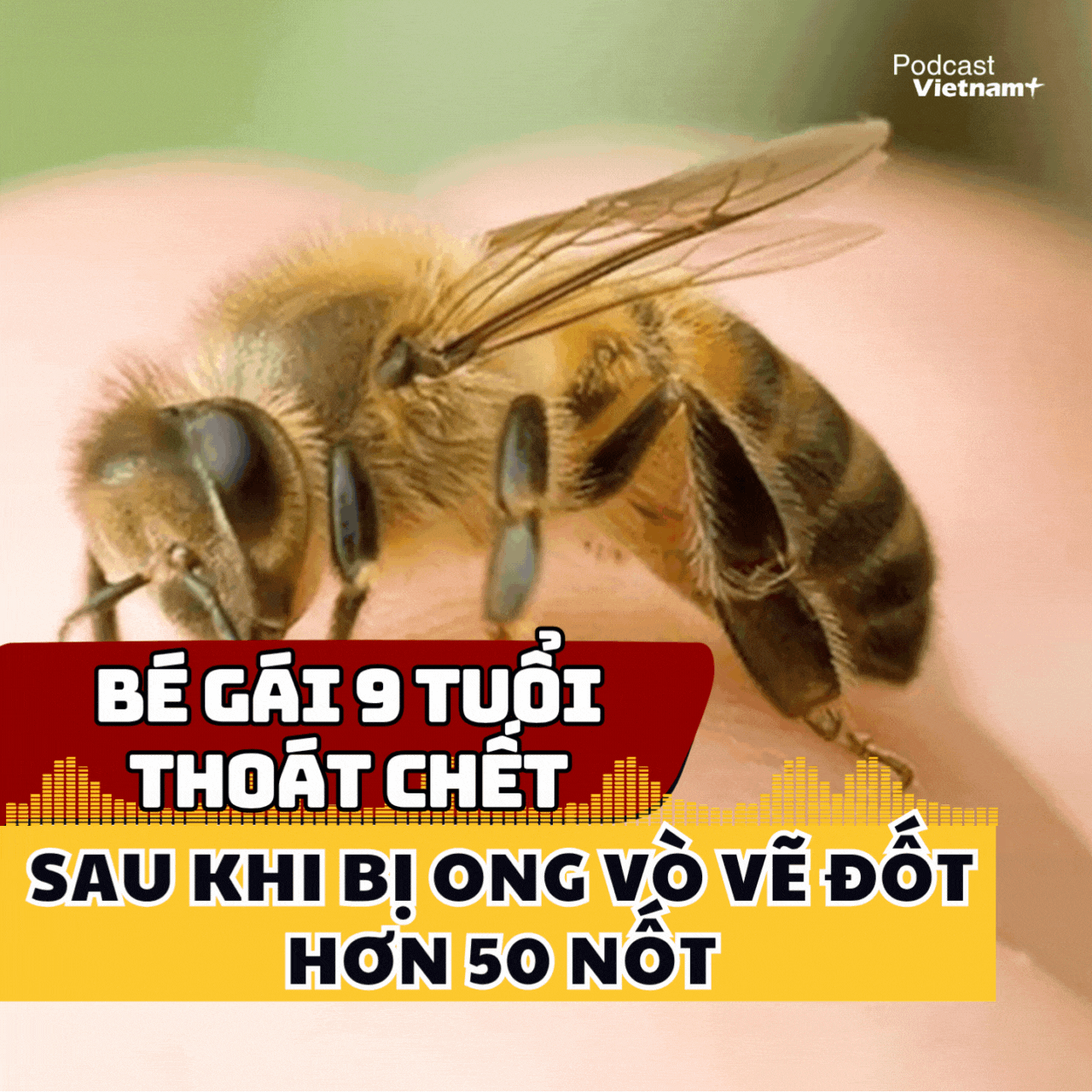 Bé gái 9 tuổi thoát chết thần kỳ sau khi bị ong đốt hơn 50 nốt 