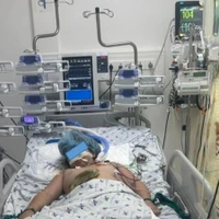 Cứu sống bé gái bị tổn thương lóc da hiếm gặp do tai nạn giao thông