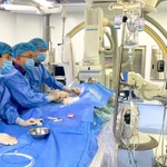 Các bác sỹ Bệnh viện 19-8 thực hiện ca can thiệp tim mạch phức tạp cho bệnh nhân. (Ảnh: PV/Vietnam+)