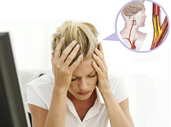 Chớ chủ quan với chứng đau đầu khi thời tiết thay đổi ảnh 1