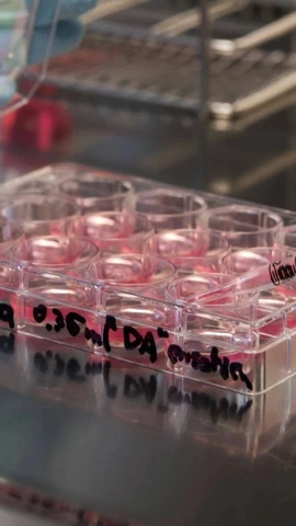 Một thử nghiệm lâm sàng cho thấy việc cấy ghép các cụm tế bào cơ tim được tạo ra từ tế bào iPS vào bệnh nhân suy tim nặng đã giúp cải thiện chức năng tim. (Nguồn: Getty Images)