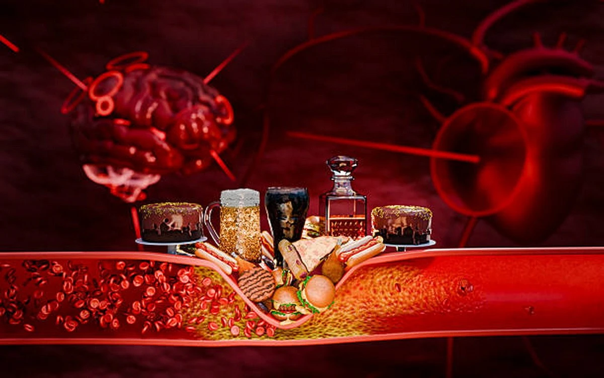 Người có cholesterol cao cần tránh những loại thực phẩm nào?