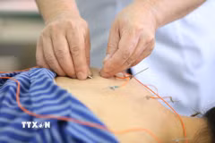 Cục Quản lý Y, Dược cổ truyền yêu cầu Sở Y tế các tỉnh, thành phố trực thuộc Trung ương chỉ đạo các cơ sở hoạt động trong lĩnh vực y, dược cổ truyền thực hiện nghiêm quy định pháp luật về khám bệnh, chữa bệnh, sản xuất, kinh doanh thuốc và các sản phẩm y học cổ truyền. (Ảnh: Anh Tuấn/TTXVN)