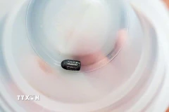Viên đạn ghim vào đầu chị Th. được các bác sỹ Bệnh viện Đa khoa Trung ương Cần Thơ phẫu thuật lấy ra thành công. (Ảnh: TTXVN phát)