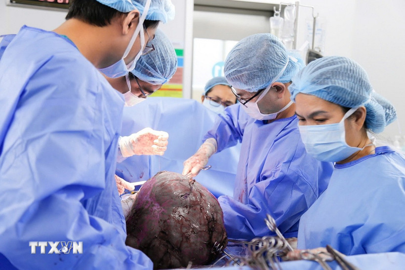 Các bác sỹ Bệnh viện Từ Dũ Thành phố Hồ Chí Minh tiến hành phẫu thuật bóc tách khối u xơ tử cung khổng lồ cho Bet88com casino, thể thao, bắn cá, nổ hũ. (Ảnh: TTXVN phát)