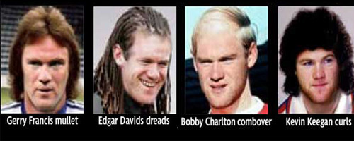 Rooney lộ đầu đầy sẹo sau khi đi chữa bệnh hói ảnh 2