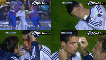 Video Ronaldo đổ máu vì đòn hiểm của đối phương ảnh 1