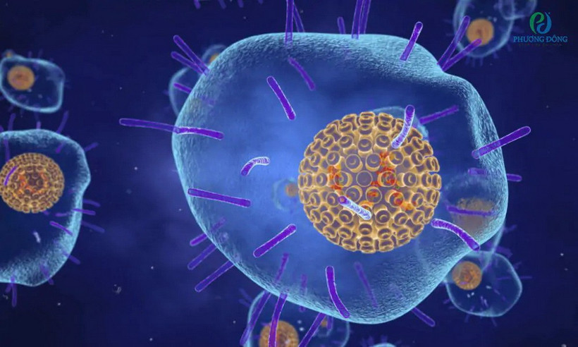 Virus thủy đậu còn được gọi là Varicella Zoster virus là tác nhân gây ra bệnh zona thần kinh.