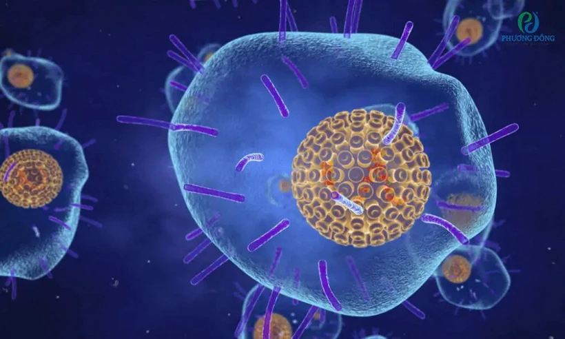 Virus thủy đậu còn được gọi là Varicella Zoster virus là tác nhân gây ra bệnh zona thần kinh.