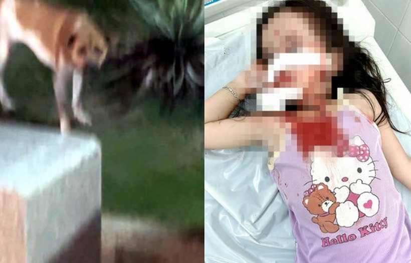 TP Hồ Chí Minh: Bé gái 4 tuổi bị chó tấn công, thương tích nghiêm trọng vùng mặt