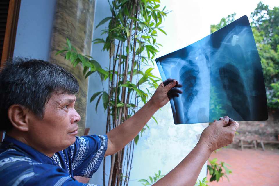 Ông Sơn khoe tấm phim chụp có hình mảnh đạn bị găm vào cột sống. Khi được hỏi, bị thương như thế, ông làm sao dạy võ được? Ông Sơn cười bảo: ‘Tôi có trợ giảng riêng rất giỏi giúp tôi những động tác khó, còn những kỹ thuật đơn giản tôi vẫn xử lý được hết’. (Ảnh: Minh Sơn/Vietnam+)