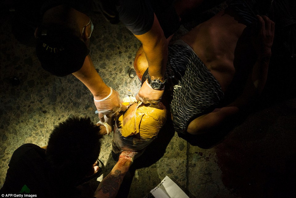 Một tên tội phạm bị người dân trừng phạt bằng cách dán băng dính quanh đầu. (Nguồn: Dailymail)