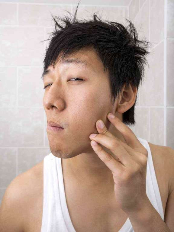 Các nốt ruồi có sự thay đổi về hình dáng, kích thước, màu sắc. (Nguồn: Getty Images)