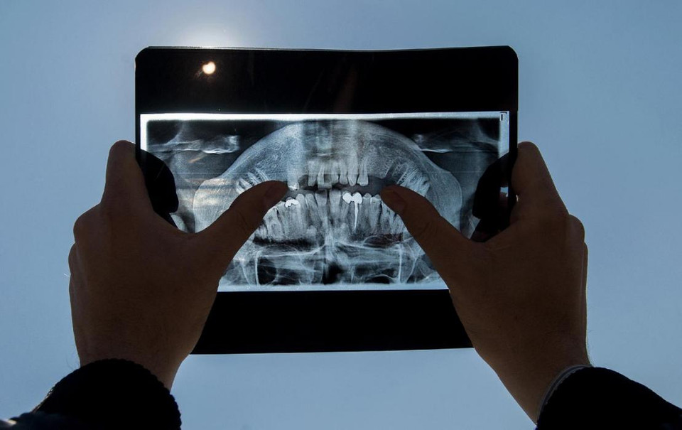 Một người đàn ông sử dụng tấm phim chup X-quang để theo dõi hiện tượng nhật thực một phần tại Pristina vào ngày 20 tháng 3. (Nguồn: AFP)