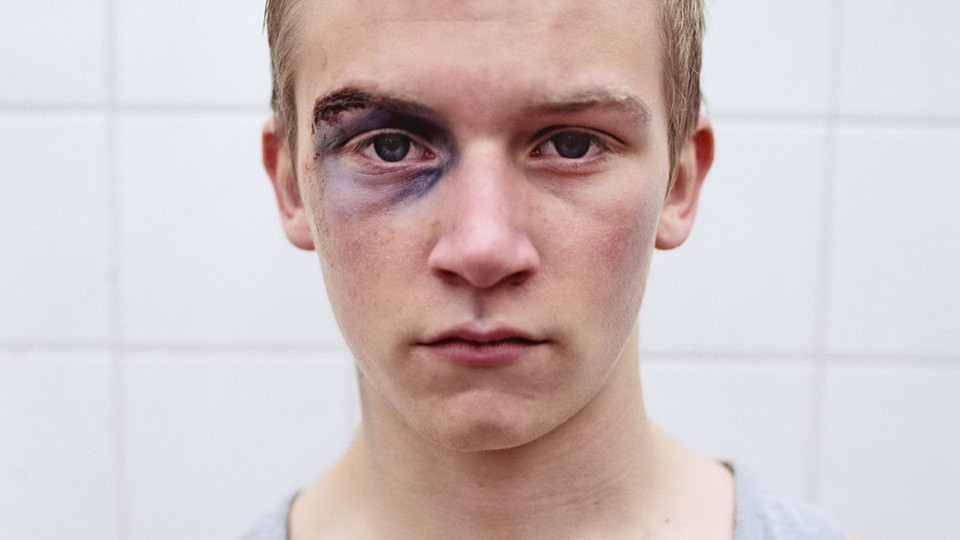 Những vết thương không thể giải thích. (Nguồn: Getty Images)