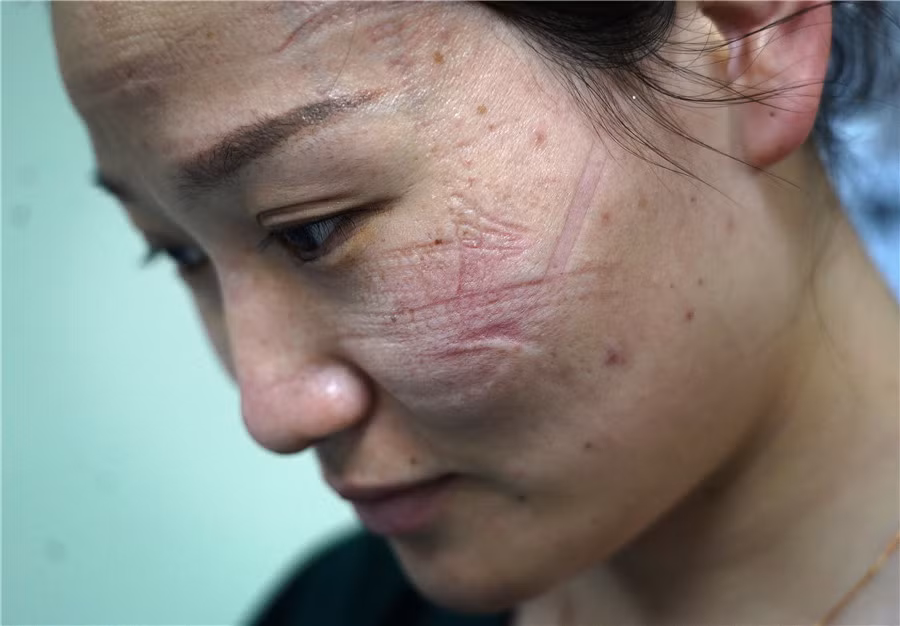 (Nguồn: Xinhua)