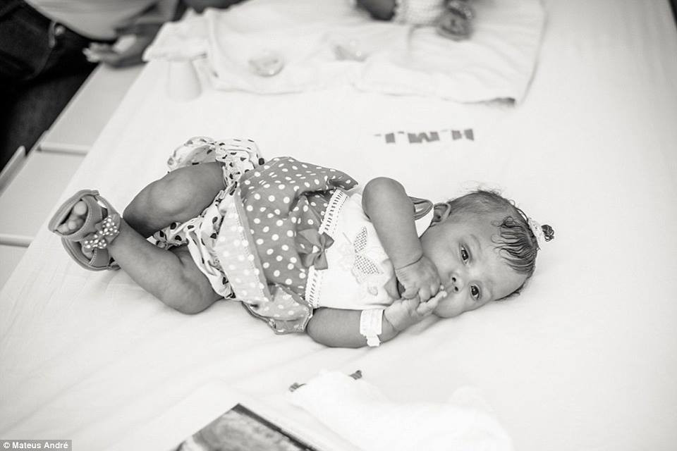 Những cặp song sinh dính liền rất hiếm khi xảy ra, tỷ lệ gặp là 1/200.000. (Nguồn: CCTVNews)