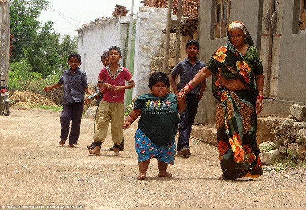 Amisha Nandwana, 3 tuổi, đang bước đi cùng những người họ hàng của mình sau khi giảm cân. (Nguồn: Cover Asia Press)