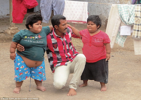 Chỉ 3 tháng trước thôi thì Yogita (phải) có cân nặng 34kg còn Amisa (trái) có cân nặng 48kg. Hai bé không thể tự làm bất cứ việc gì dù là tự đứng trên đôi chân của mình. (Nguồn: Cover Asia Press)