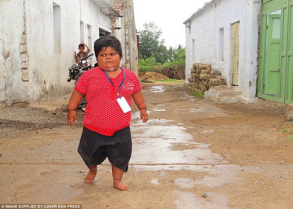 Yogita, 5 tuổi, cùng với chị của mình đã cùng nhau giảm được tổng cộng 6kg. Trước đây, ngày nào các em cũng ăn 18 chiếc chapati, 1,3 kg gạo, 2 bát súp, 6 gói khoai tây chiên, 5 gói bánh quy, 12 quả chuối và 1 lít sữa. (Nguồn: Cover Asia Press)