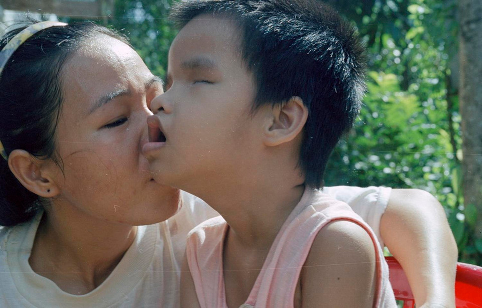 Chị Trương Thị Thi (thôn Nghĩa Phong, xã Cam Nghĩa, huyện Cam Lộ, tỉnh Quảng Trị) và con bị di chứng chất độc da cam/dioxin (2002). (Ảnh: Ngô Mỹ/TTXVN)