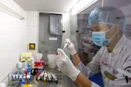Phòng thí nghiệm Công nghệ Sinh học của Trường Đại học Quốc tế, Đại học Quốc gia Thành phố Hồ Chí Minh thực hiện nhiều nghiên cứu chuyên sâu, kỹ thuật nguồn trên thế giới. (Ảnh: Thanh Vũ/TTXVN)