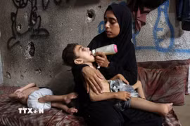 Trẻ em Palestine tại Dải Gaza bị suy dinh dưỡng nghiêm trọng. (Ảnh: THX/TTXVN)